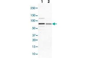 Western blot analysis of Lane 1: NIH-3T3 cell lysate (Mouse embryonic fibroblast cells); Lane 2: NBT-II cell lysate (Rat Wistar bladder tumour cells) with IGF2BP3 polyclonal antibody  at 1:100-1:250 dilution. (IGF2BP3 anticorps)