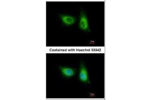 ICC/IF Image Immunofluorescence analysis of methanol-fixed A549, using SOS2, antibody at 1:500 dilution. (SOS2 anticorps  (Center))