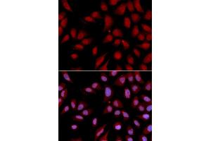 Immunofluorescence analysis of U2OS cell using DLGAP5 antibody. (DLGAP5 anticorps)