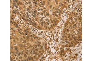 Immunohistochemistry (IHC) image for anti-Vacuole Membrane Protein 1 (VMP1) antibody (ABIN2427419)