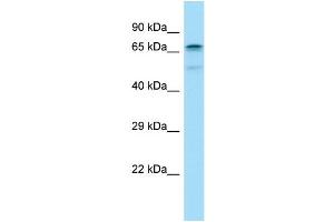WB Suggested Anti-CABLES1 Antibody Titration: 1.