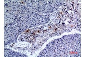 Immunohistochemistry (IHC) analysis of paraffin-embedded Human Lung, antibody was diluted at 1:100. (IREM1 anticorps  (Internal Region))
