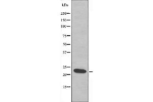 Western blot analysis of extracts from COLO cells, using MRPL21 antibody. (MRPL21 anticorps  (Internal Region))