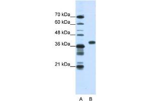WB Suggested Anti-PCBP1 Antibody Titration:  1. (PCBP1 anticorps  (Middle Region))