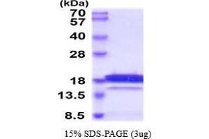 Retinoic Acid Receptor Responder (Tazarotene Induced) 2 (RARRES2) (AA 21-157) protein (His tag)