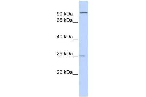 WB Suggested Anti-SSPN Antibody Titration:  0. (SSPN anticorps  (Middle Region))