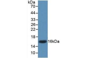 Detection of Recombinant IL17, Mouse using Monoclonal Antibody to Interleukin 17 (IL17)
