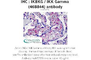 Image no. 1 for anti-Inhibitor of kappa Light Polypeptide Gene Enhancer in B-Cells, Kinase gamma (IKBKG) antibody (ABIN5693607)