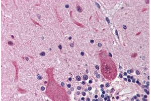 Human Brain, Cerebellum (formalin-fixed, paraffin-embedded) stained with RRM2B antibody ABIN214469 at 2. (RRM2B anticorps  (AA 2-17))