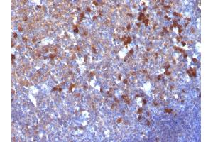 Formalin-fixed, paraffin-embedded human Tonsil stained with IgG Monoclonal Antibody (IG217) (IGHG anticorps)
