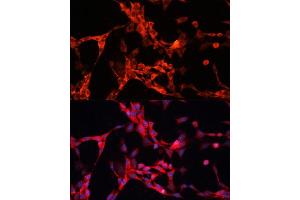 Immunofluorescence analysis of NIH/3T3 cells using GSK3α antibody (ABIN1680131, ABIN3015275, ABIN3015276 and ABIN6213918) at dilution of 1:100.