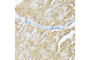Immunohistochemistry of paraffin-embedded mouse heart using TP53I11 antibody (ABIN6131365, ABIN6149418, ABIN6149419 and ABIN6216636) at dilution of 1:100 (40x lens). (TP53I11 anticorps  (AA 1-70))