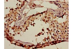 Immunohistochemistry of paraffin-embedded human testis tissue using ABIN7143025 at dilution of 1:100 (ACRV1 anticorps  (AA 22-265))