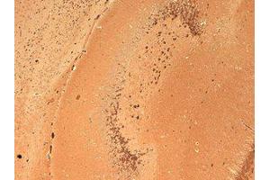 GluR2 Immunohistochemistry.