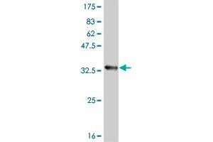 Western Blot detection against Immunogen (33. (ATOX1 anticorps  (AA 1-68))