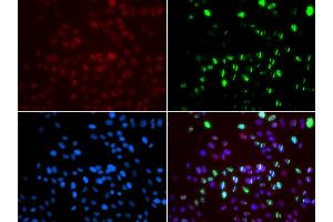 Immunofluorescence analysis of GFP-RNF168 transgenic U2OS cells using MSH6 antibody (ABIN5971626). (MSH6 anticorps)