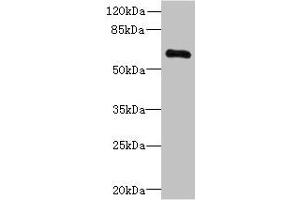 Western blot All lanes: PPP2R1B antibody at 3. (PPP2R1B anticorps  (Regulatory Subunit A))