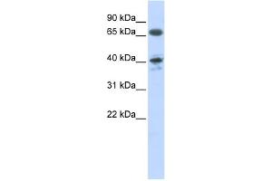 WB Suggested Anti-AGTR1 Antibody Titration:  0.