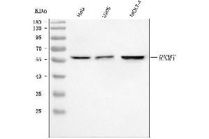Western blot analysis of RNMT using anti-RNMT antibody (ABIN7600451).