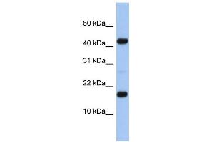 WB Suggested Anti-FLJ37543 Antibody Titration: 0. (FLJ37543 anticorps  (N-Term))