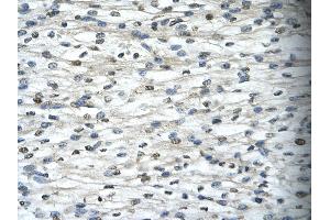 Rabbit Anti-TAF15 Antibody       Paraffin Embedded Tissue:  Human cardiac cell   Cellular Data:  Epithelial cells of renal tubule  Antibody Concentration:   4.