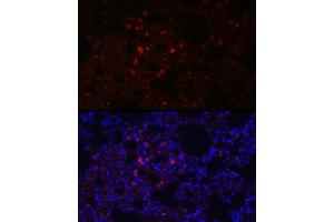 Immunofluorescence analysis of rat lung using SFTPC Rabbit pAb (ABIN3015597, ABIN3015598, ABIN3015599, ABIN1682683 and ABIN6218961) at dilution of 1:100 (40x lens). (Surfactant Protein C anticorps  (AA 1-197))