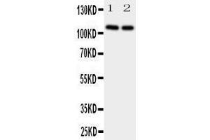 Western Blotting (WB) image for anti-Neuropilin 2 (NRP2) (AA 45-60), (N-Term) antibody (ABIN3044160) (NRP2 anticorps  (N-Term))