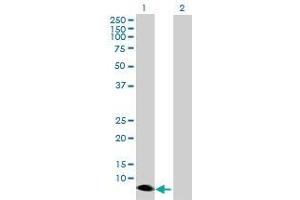 Lane 1: PTGES transfected lysate ( 16. (PTGES 293T Cell Transient Overexpression Lysate(Denatured))