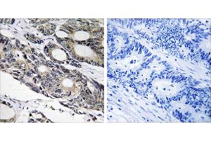 Peptide - + (BCL10 anticorps)