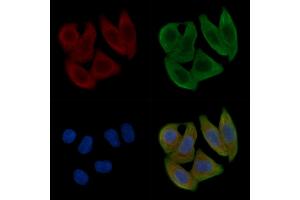 ABIN6263936 and ABIN6266609 staining Hela cells(30 min of UV treatment) by IF/ICC.