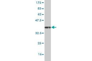 Western Blot detection against Immunogen (36. (HSF4 anticorps  (AA 121-220))