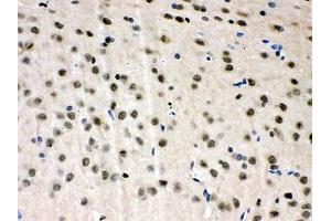 IHC-P: VCP antibody testing of rat brain tissue