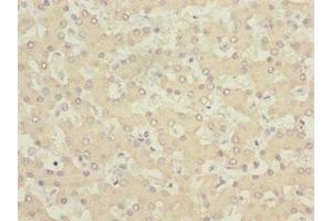 Immunohistochemistry of paraffin-embedded human liver tissue using ABIN7153515 at dilution of 1:100 (GABARAPL1 anticorps  (AA 1-117))