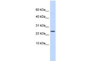 WB Suggested Anti-LYPD6 Antibody Titration: 0. (LYPD6 anticorps  (Middle Region))