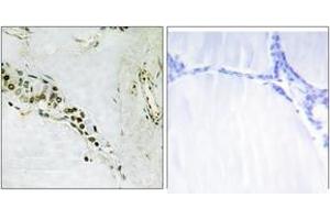 Immunohistochemistry analysis of paraffin-embedded human thyroid gland tissue, using Cyclin E2 (Ab-392) Antibody. (Cyclin E2 anticorps  (AA 355-404))