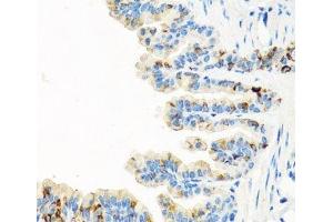 Immunohistochemistry of paraffin-embedded Mouse lung using RGS5 Polyclonal Antibody at dilution of 1:100 (40x lens). (RGS5 anticorps)