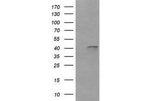 Image no. 5 for anti-Parvin, alpha (PARVA) antibody (ABIN1496442)