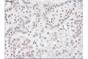 Image no. 2 for anti-Glial Fibrillary Acidic Protein (GFAP) antibody (ABIN1498440) (GFAP anticorps)