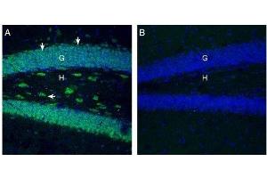 Expression of SLC7A2 (CAT-2) in mouse hippocampus  - Immunohistochemical staining of perfusion-fixed frozen mouse brain sections with Anti-SLC7A2 (extracellular) Antibody (ABIN7043748, ABIN7044831 and ABIN7044832), (1:300), followed by goat anti-rabbit-AlexaFluor-488.