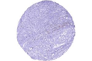 anti-T Cell Immunoreceptor with Ig and ITIM Domains (TIGIT) antibody