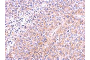 Image no. 1 for anti-Tubulin, beta (TUBB) (AA 160-447) antibody (ABIN1501915)