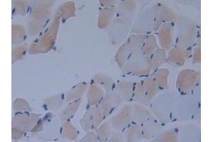 Detection of IkBd in Mouse Skeletal muscle Tissue using Polyclonal Antibody to Inhibitory Subunit Of NF Kappa B Delta (IkBd) (IkBd anticorps  (AA 58-304))
