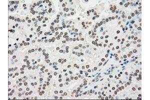 Image no. 13 for anti-Premelanosome Protein (PMEL) antibody (ABIN1500300)