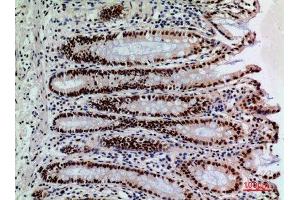 Immunohistochemistry (IHC) analysis of paraffin-embedded Human Colon, antibody was diluted at 1:100. (SLAMF1 anticorps  (Tyr1096))