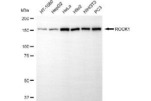 anti-rho-Associated, Coiled-Coil Containing Protein Kinase 1 (ROCK1) antibody