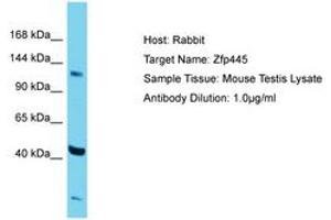 Image no. 1 for anti-Zinc Finger Protein 445 (ZNF445) (AA 406-455) antibody (ABIN6750286) (ZNF445 anticorps  (AA 406-455))