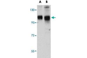 Western blot analysis of SH3BP4 in rat lung tissue lysate with SH3BP4 polyclonal antibody  at (A) 1 and (B) 2 ug/mL .