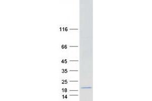 Validation with Western Blot