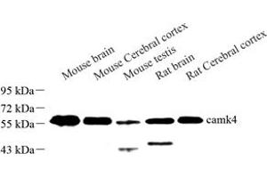 Western blot analysis of camk4 (ABIN7073281) at dilution of 1: 500 (CAMK4 anticorps)