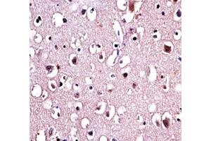 Parkin antibody immunohistochemistry analysis in formalin fixed and paraffin embedded human brain tissue.